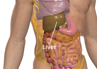 Image showing the location of the liver as part of the Sugarbaker technique. Image courtesy of 3D4Medical, with permissions.