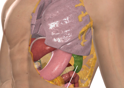 Illustration showing the location of the spleen in the body as part of the explanation of the Sugarbaker technique. Image courtesy of 3D4Medical.