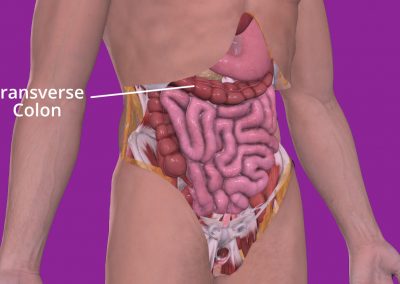 Illustration of the location of the transverse colon. Courtesy of 3D4Medical