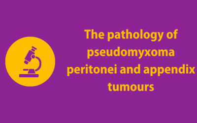 The pathology of pseudomyxoma peritonei and appendix tumours