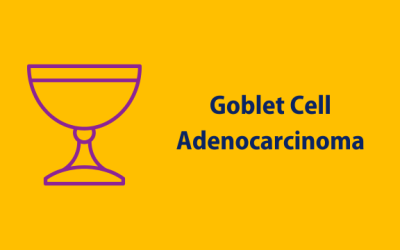 What is goblet cell adencarcinoma